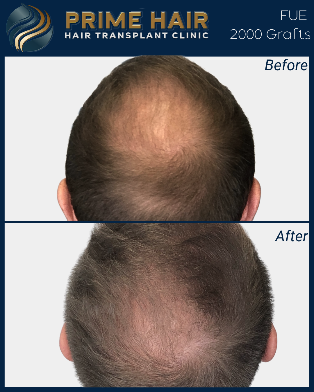 Landscape with mountains, a lake, and rolling grassy hills in the foreground under cloudy skies.