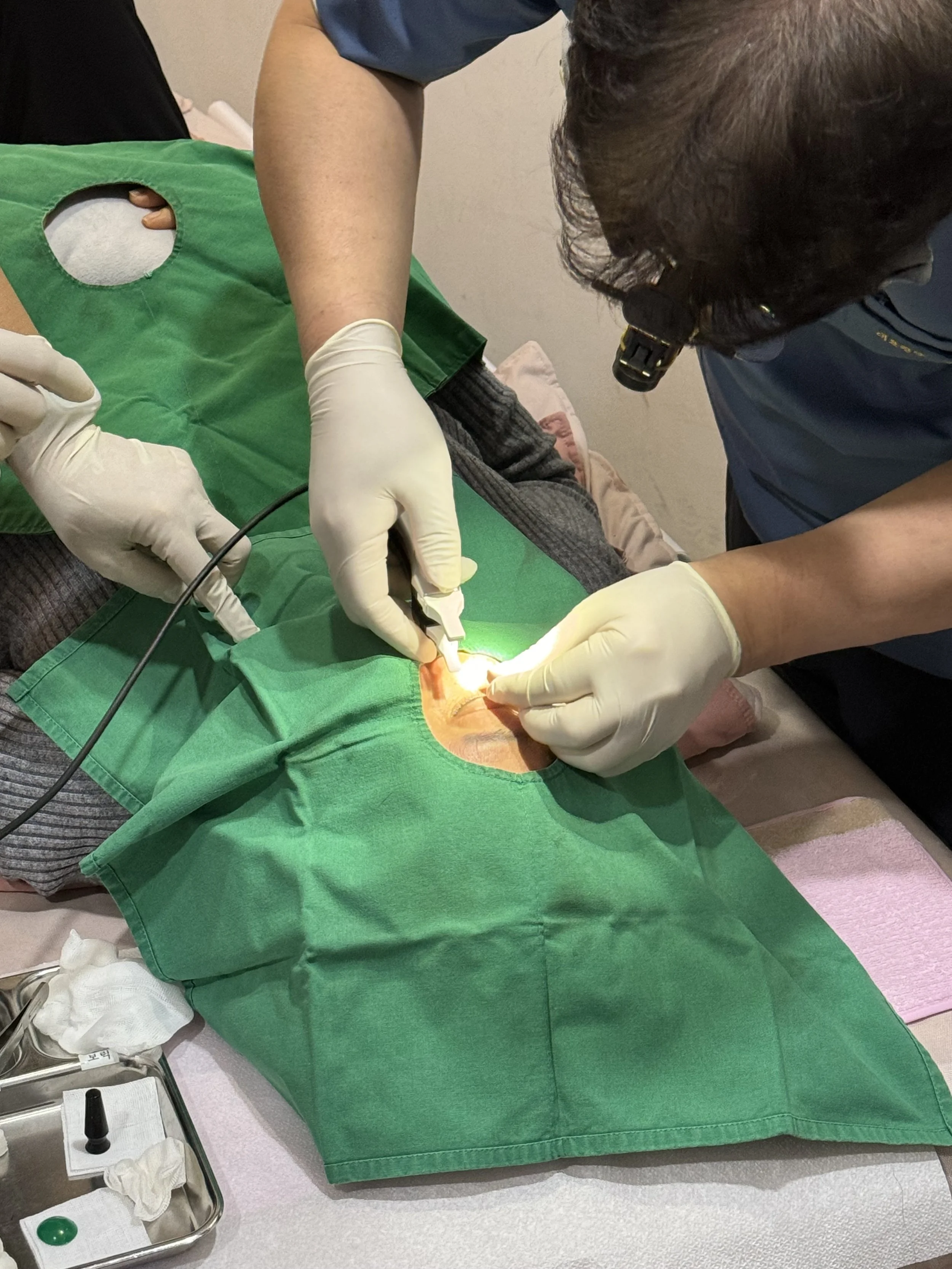 Laser Double Eyelid Procedure