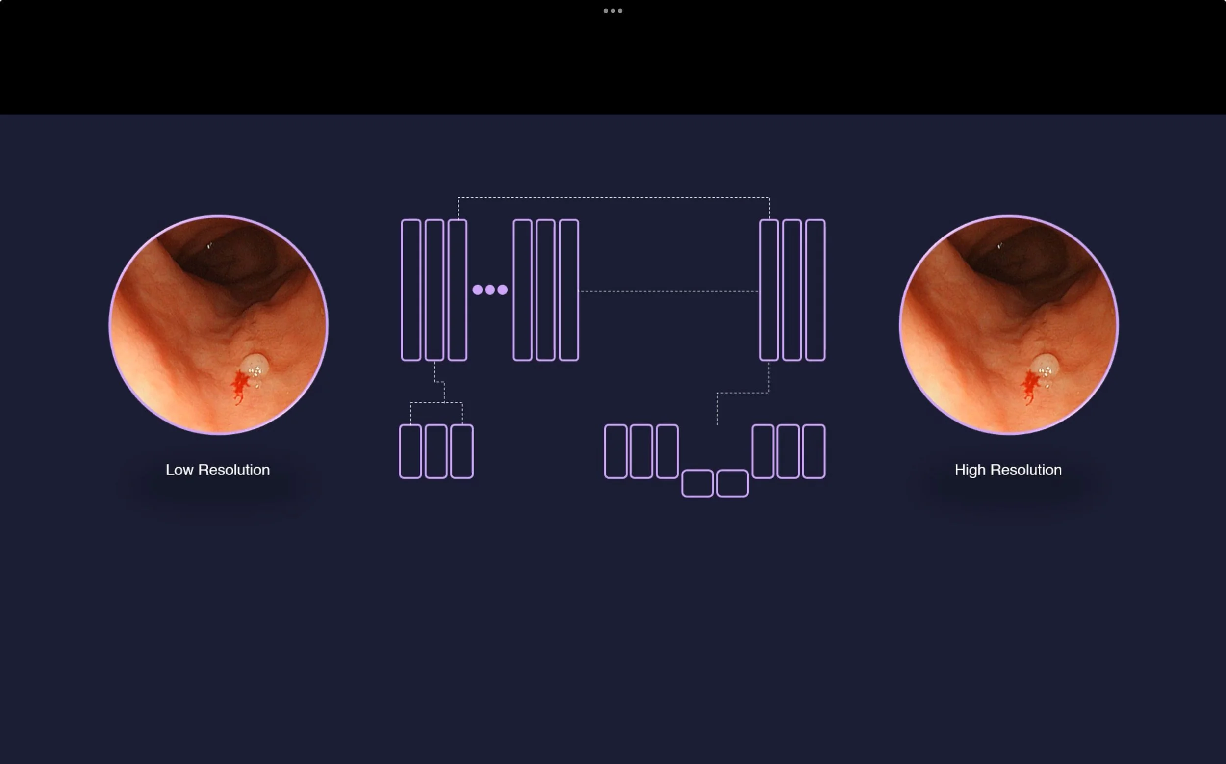Resolution Enhancement