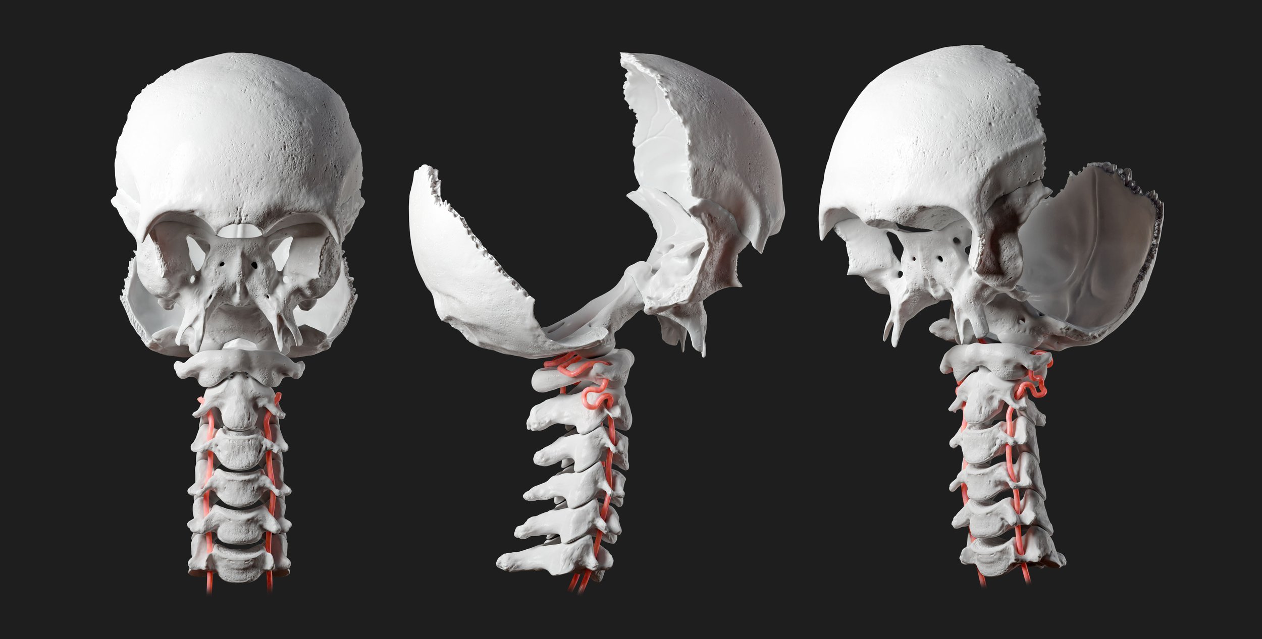 Vertebral artery animation