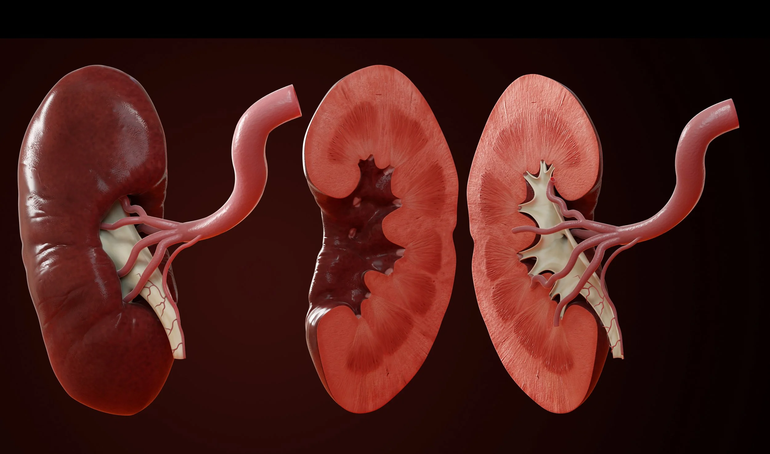 Kidney_3D.jpg