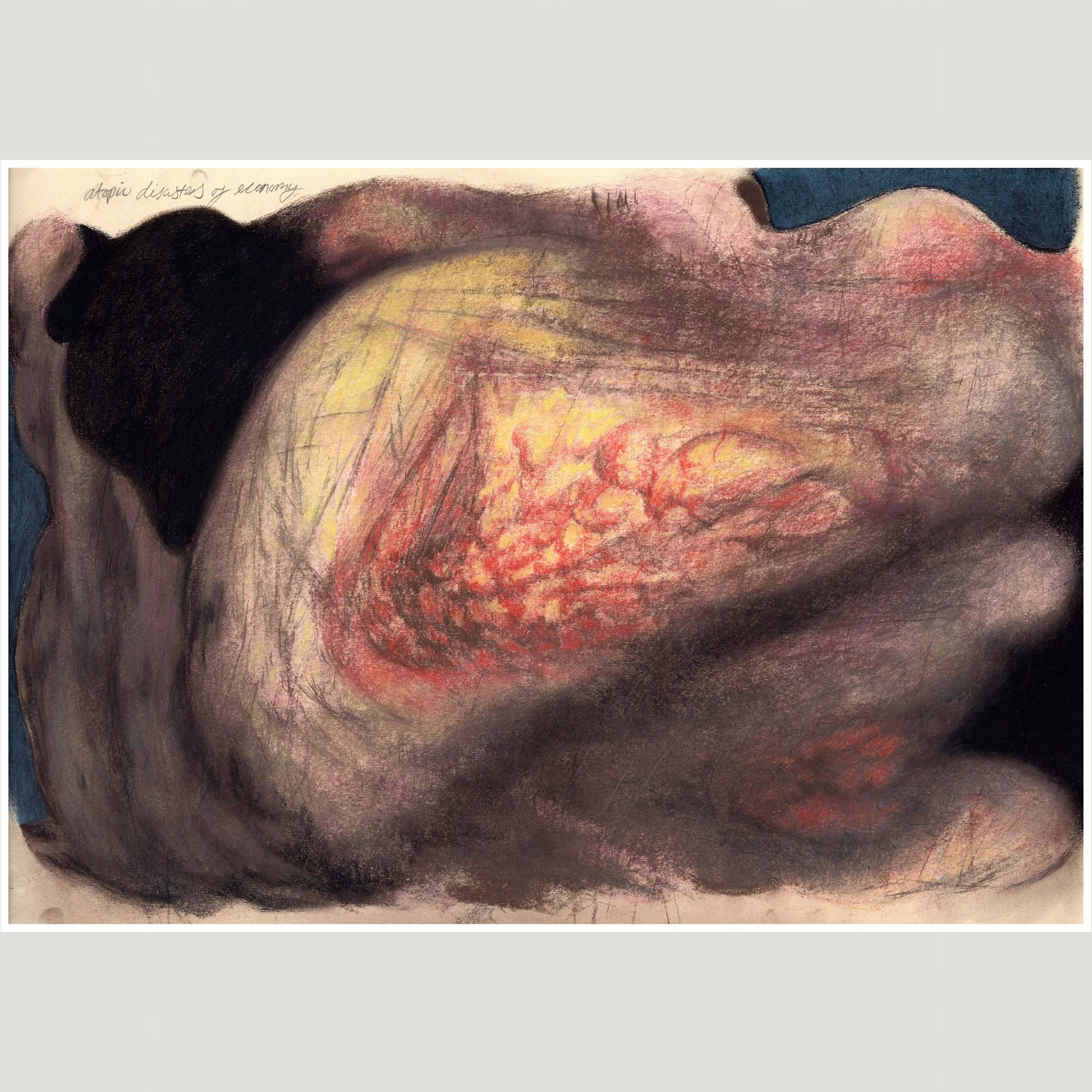 Atopic Disasters of Economy [01]