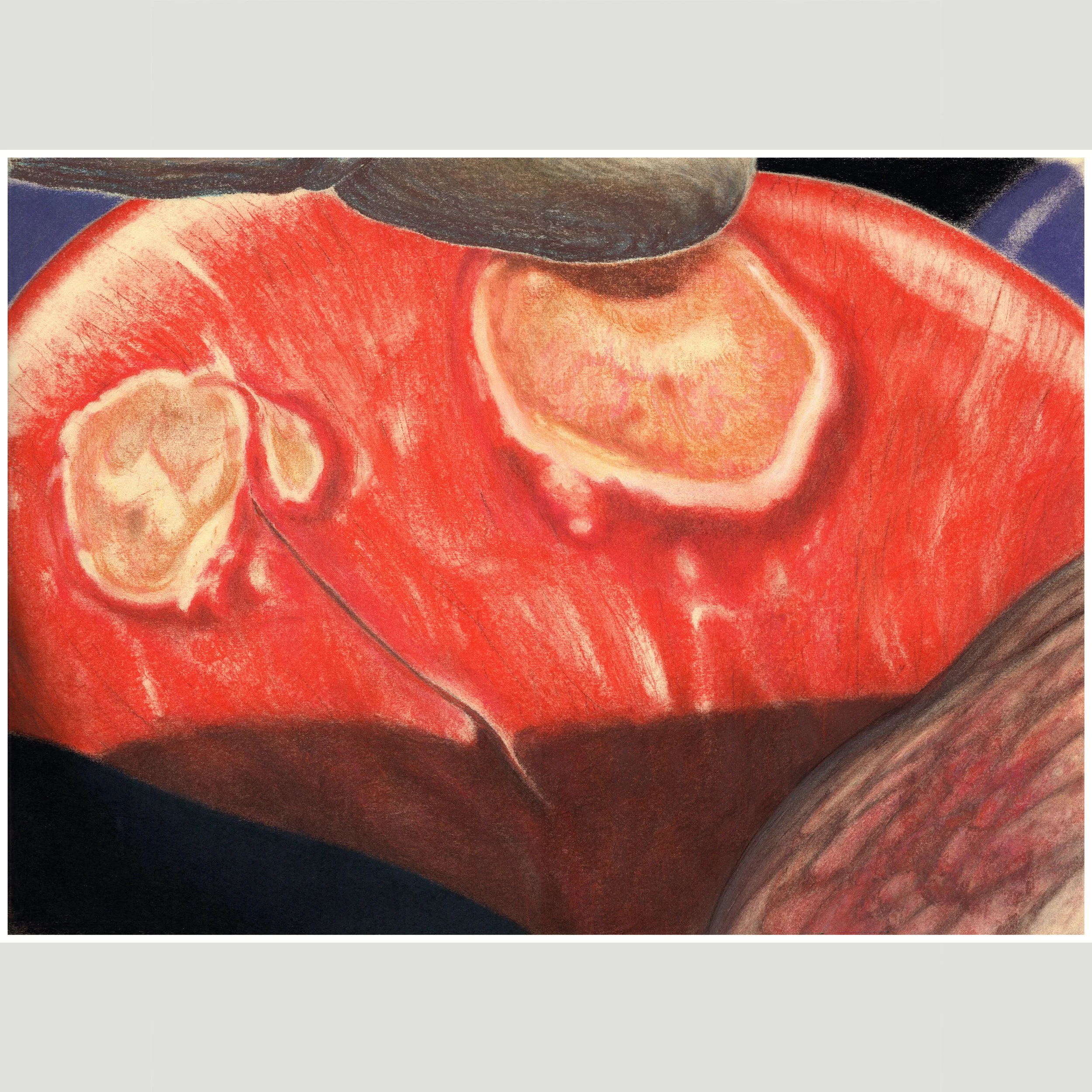 Atopic Disasters of Economy [2]