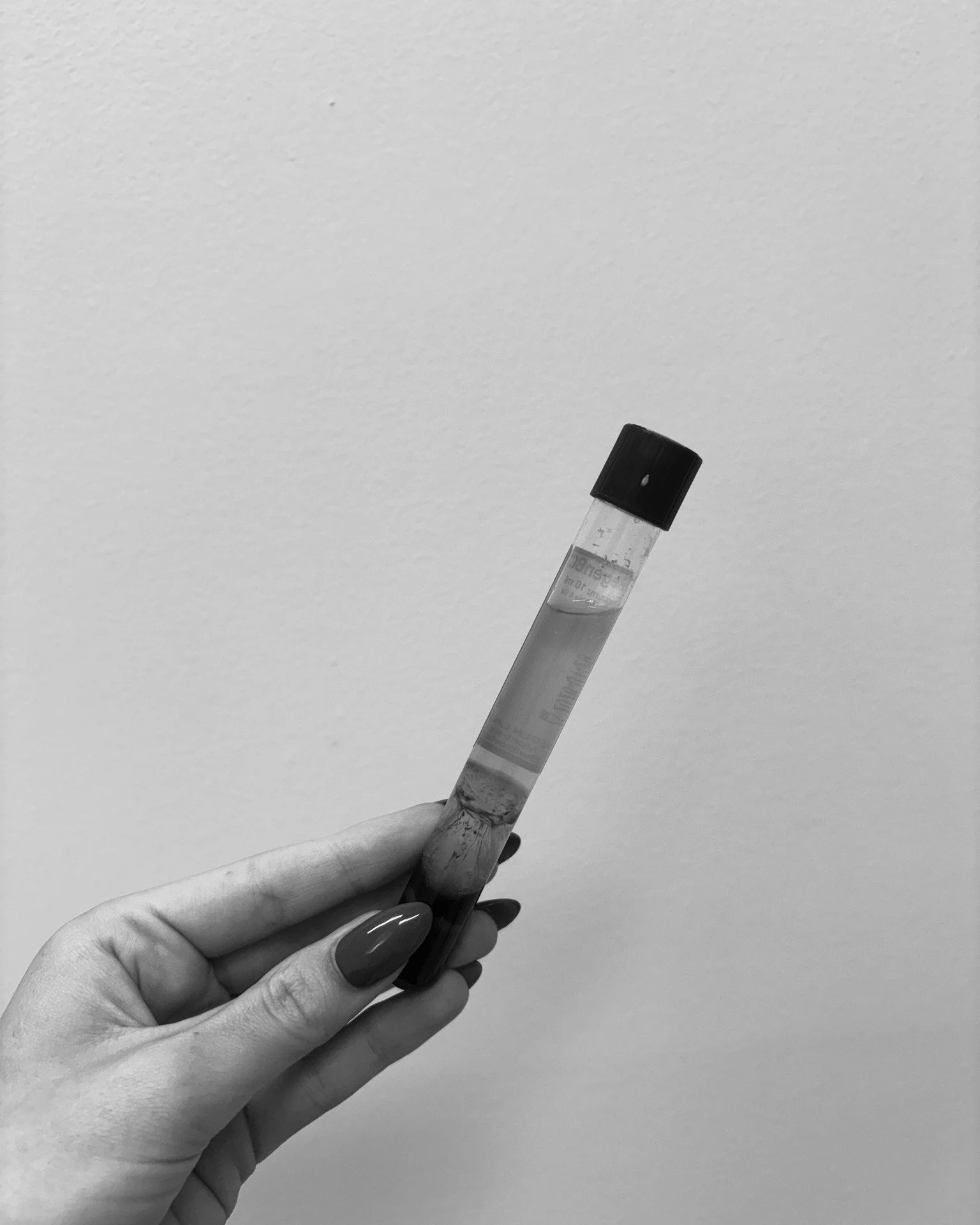 Your skin, but better &mdash; naturally.

PRP (Platelet-Rich Plasma) uses your body&rsquo;s own growth factors to boost collagen, refine texture, and restore a healthy, radiant glow 

At Perth Aesthetics, PRP can be done as a stand-alone injectable t