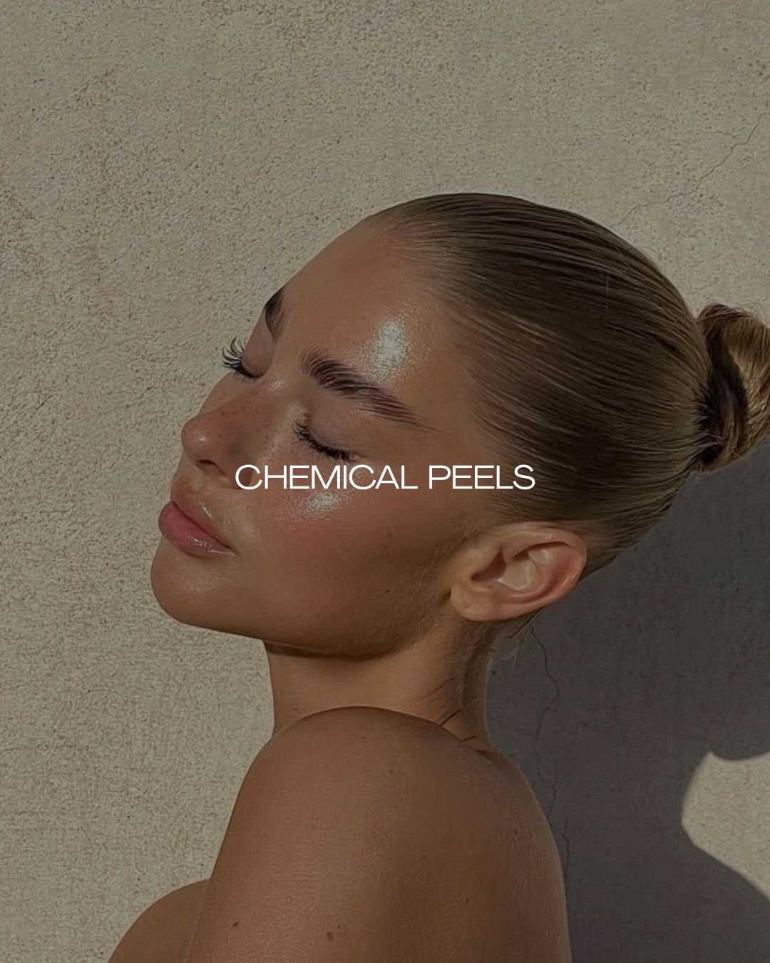 Chemical peels are designed to refine, renew, and support overall skin health by encouraging controlled cell turnover.

Using carefully selected acids, peels work to:
-Improve skin texture and tone
-Target congestion and breakouts
-Reduce pigmentatio