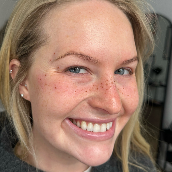 Close-up of a smiling young woman with blonde hair and blue eyes, showing her teeth and freckles on her face.