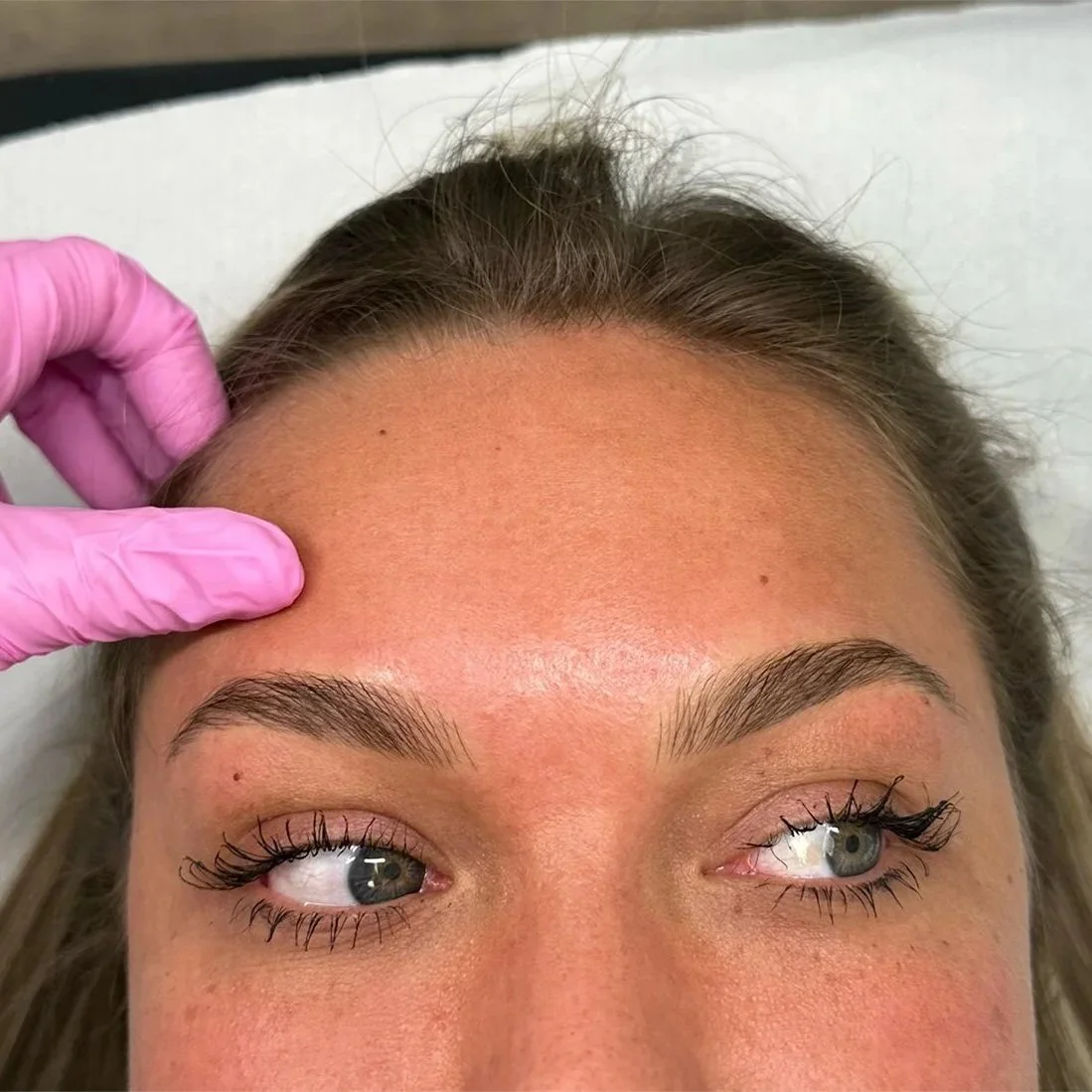 Close-up of a woman with well-groomed eyebrows, lying down, receiving a cosmetic treatment, with a gloved hand gently touching her forehead.