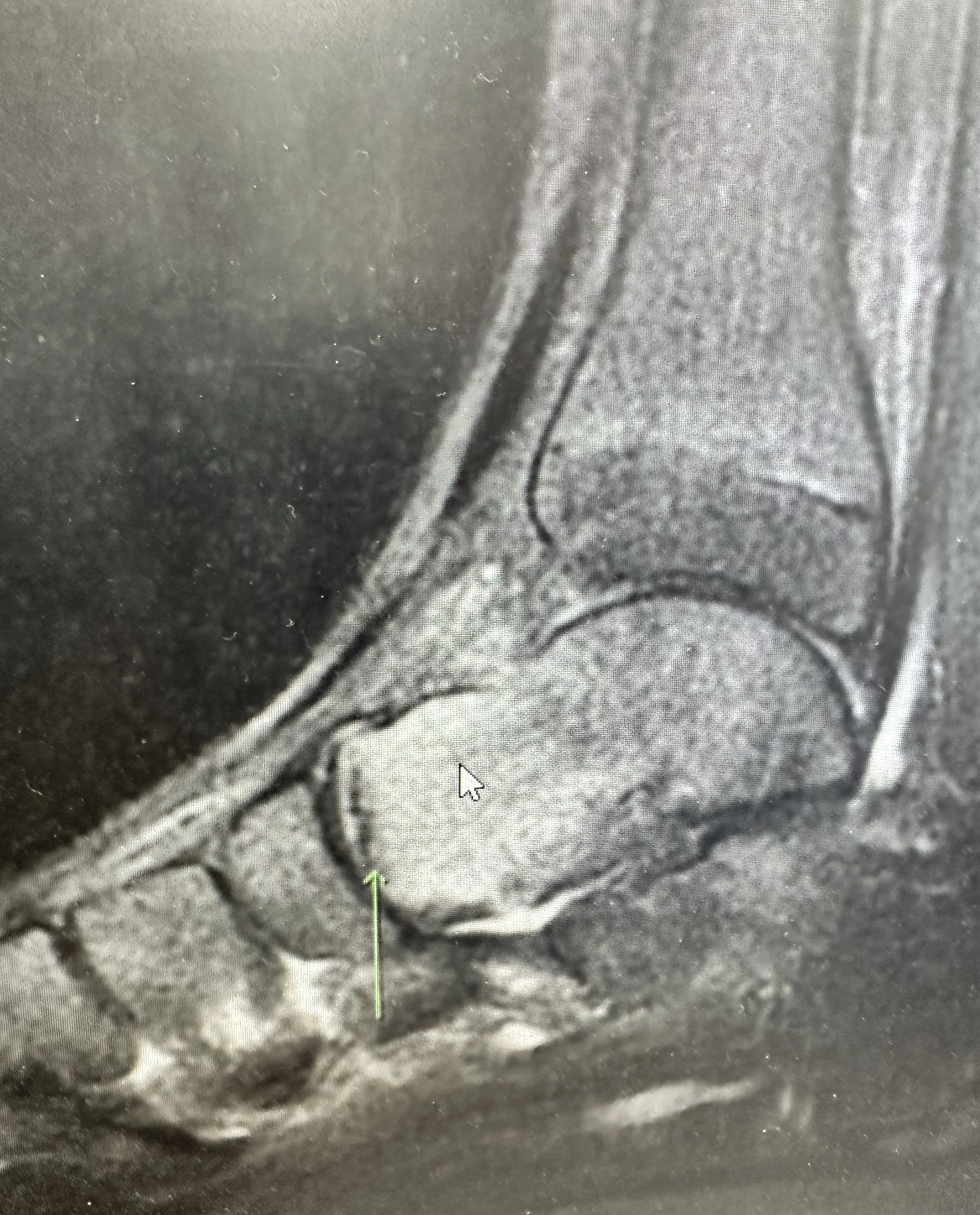 Bone Health: Building Strong Bones to Help Prevent Osteoporosis and Fractures&nbsp;