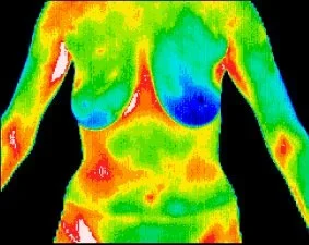 Thermal image of a human torso showing varying heat levels with different colors.