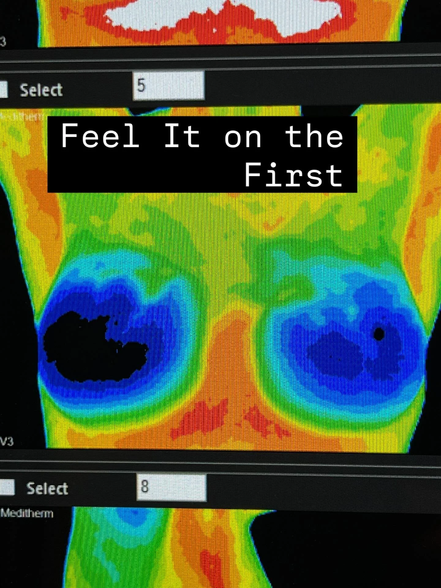 Guess what day it is??

The primary reason for performing a breast self-exam is to develop breast self-awareness&mdash;knowing how your breasts normally look and feel so you can immediately recognize and report any unusual changes to a healthcare pro