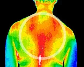 Muscular and myofascial inflammation