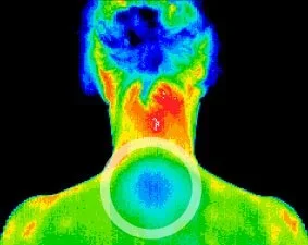 Autonomic patterns related to immune system concerns