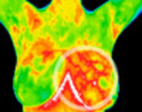 Suspicious vascular activity