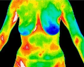 Digital Thermography