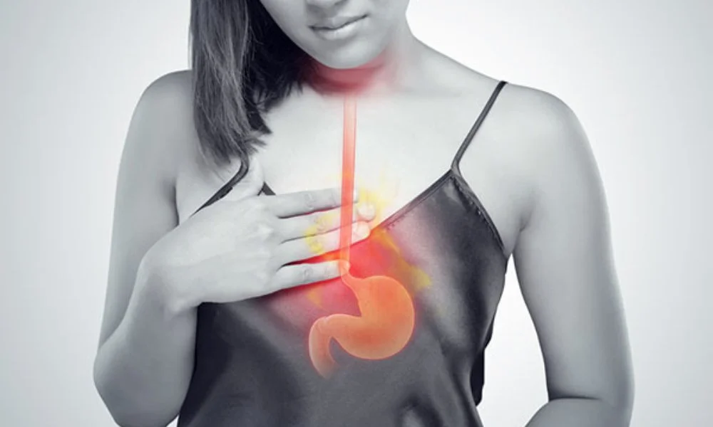 Debunking Acid Reflux