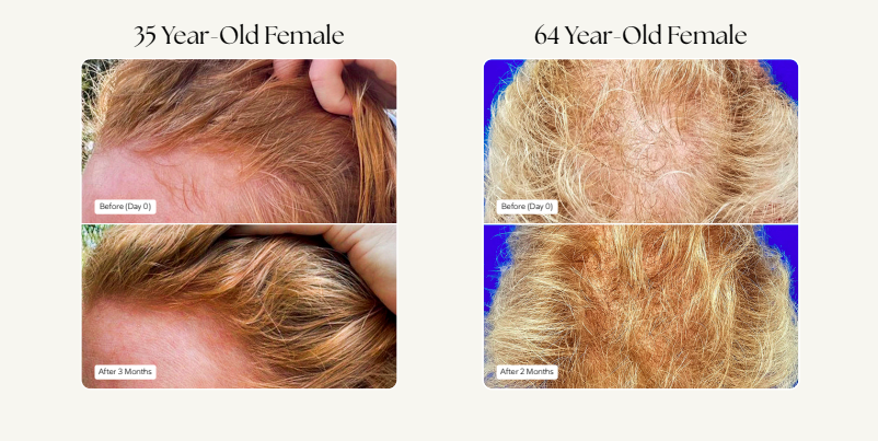 Before and After4.png