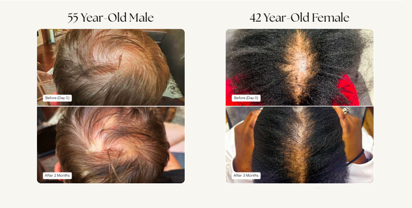 Before and After1.png