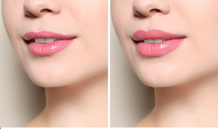 Close-up of a woman's lips in two side-by-side images, showing slight differences in lip gloss application.