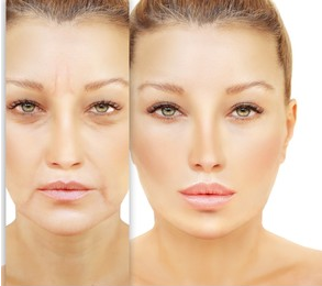 Side-by-side comparison of a woman's face before and after skincare or cosmetic treatment, showing a more youthful and smooth complexion on the right.