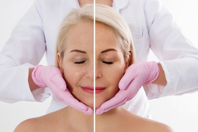 Side-by-side comparison of a woman receiving a facial massage with and without pink gloves on the practitioner, showing two different treatment techniques.