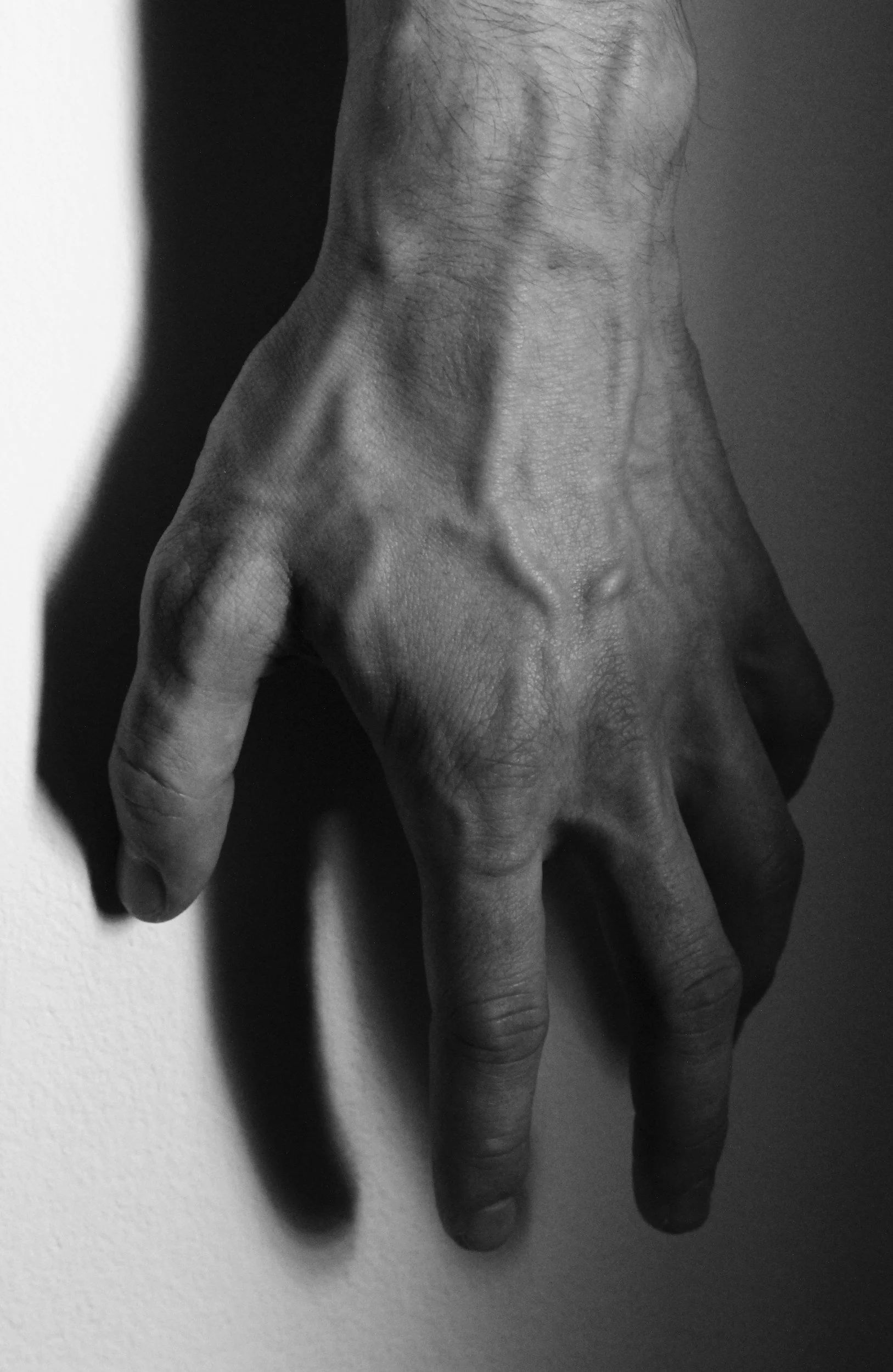 Fig. 1: Veined hands — Bianca Petrisor