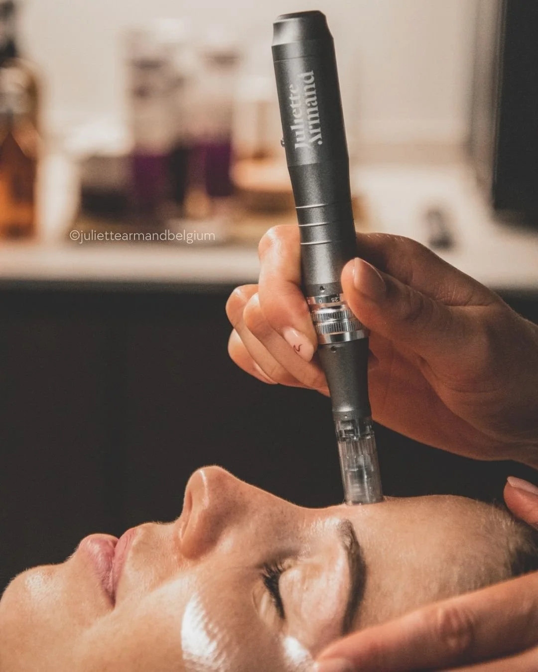 Een vrouw ligt met gesloten ogen terwijl een cosmetisch arts een mesotherapie-injectie toedient op haar voorhoofd.