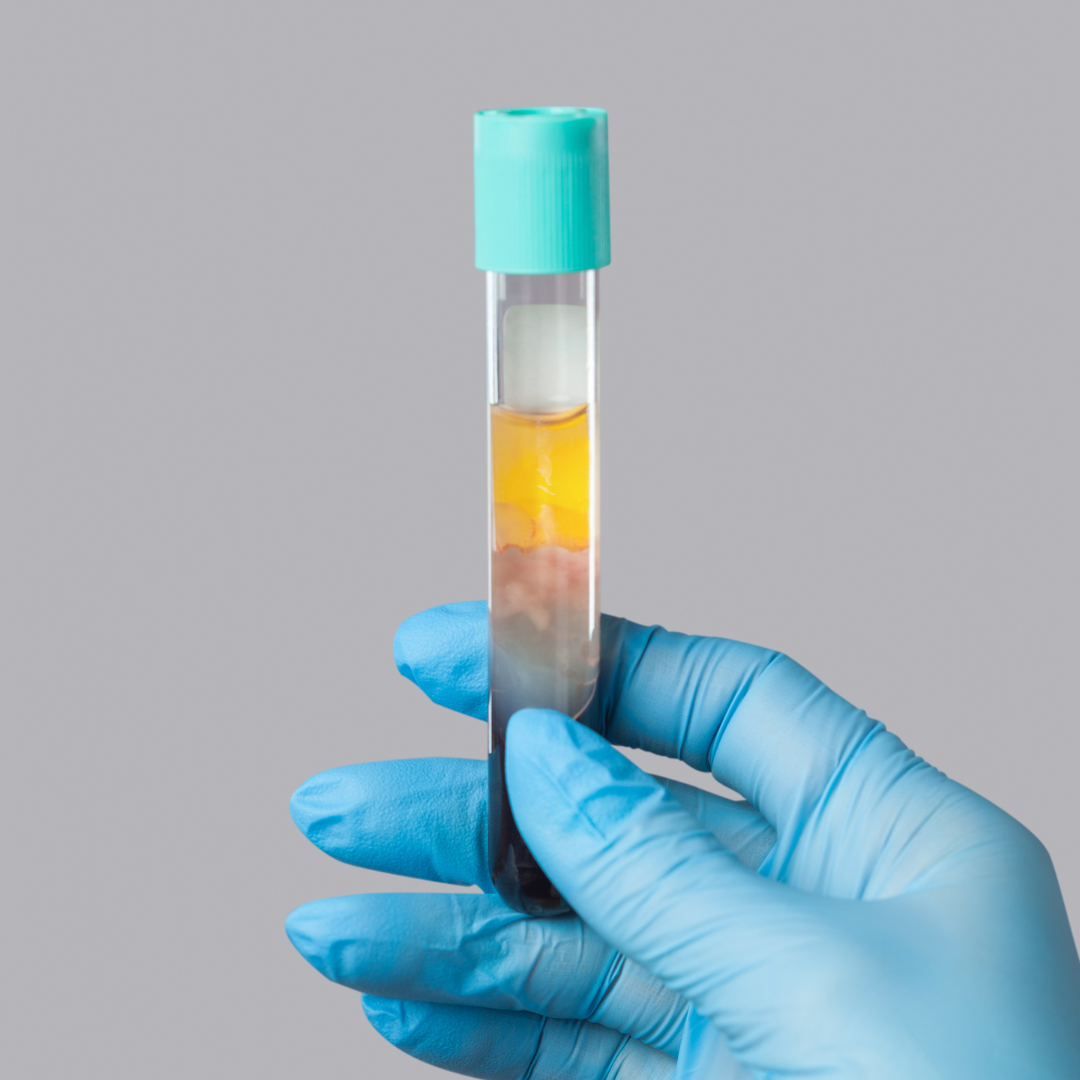 PRP vial