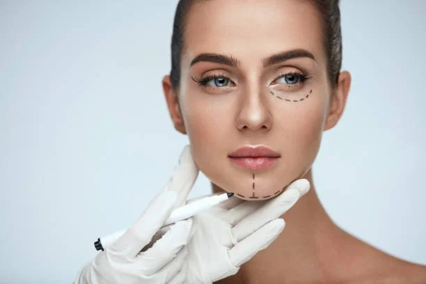 lifting paupières blépharoplastie chirurgie