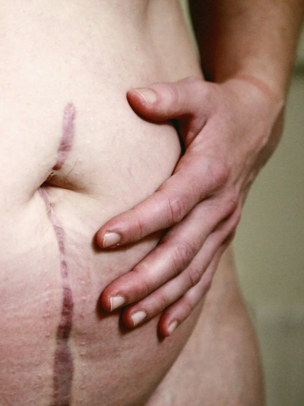 Close-up image of a white person gently resting their hand on a scarred abdomen, evoking embodied awareness, tenderness facing change and healing, vulnerability, and the relationship between pleasure and lived experience.