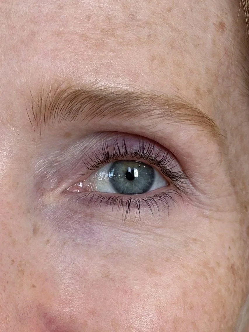 Close-up of a person's eye with blue iris, surrounded by fair skin and light freckles.