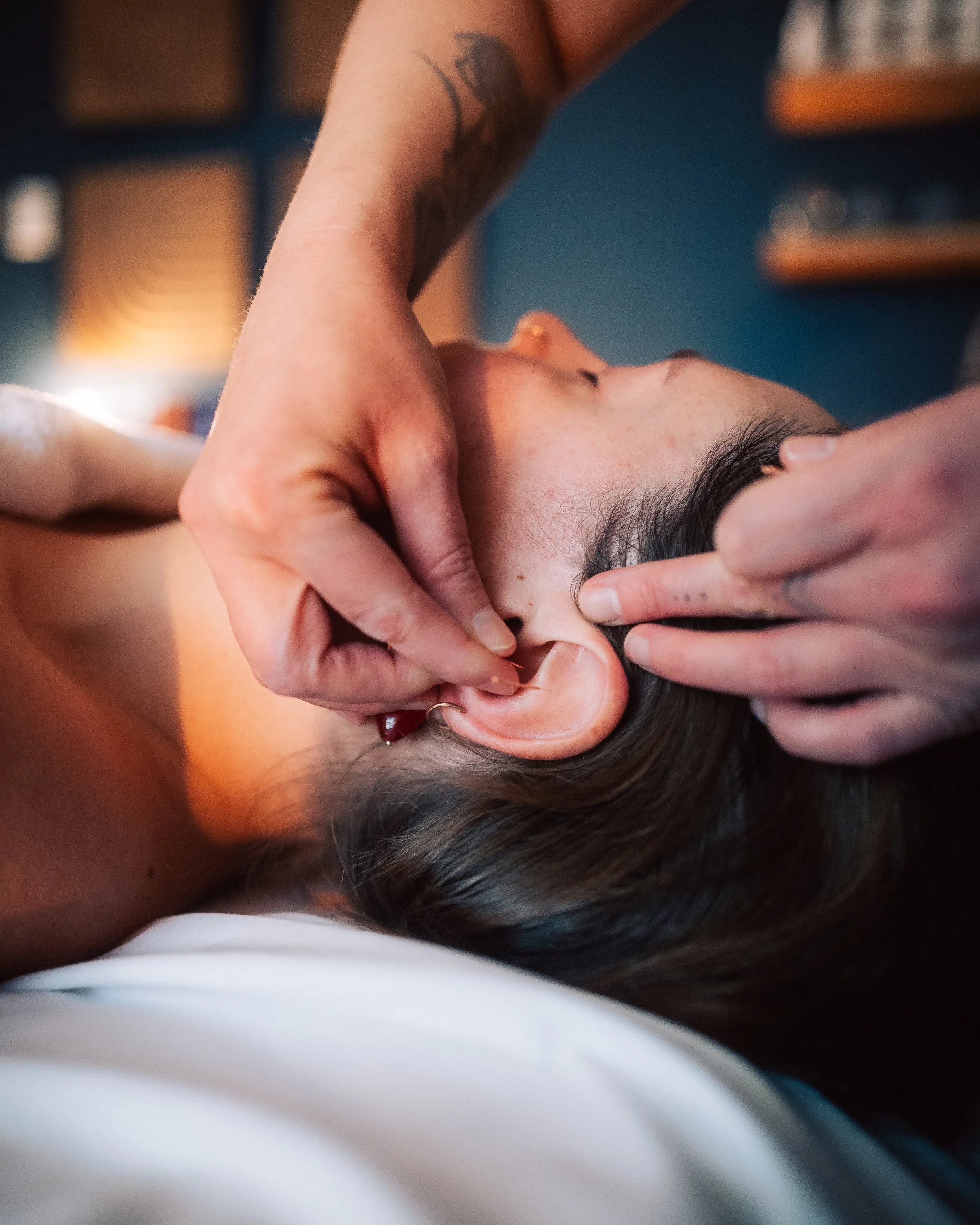 Auricular Acupuncture in Calgary: How Ear Acupuncture Supports Stress, Nervous System Regulation &amp; Whole-Body Healing