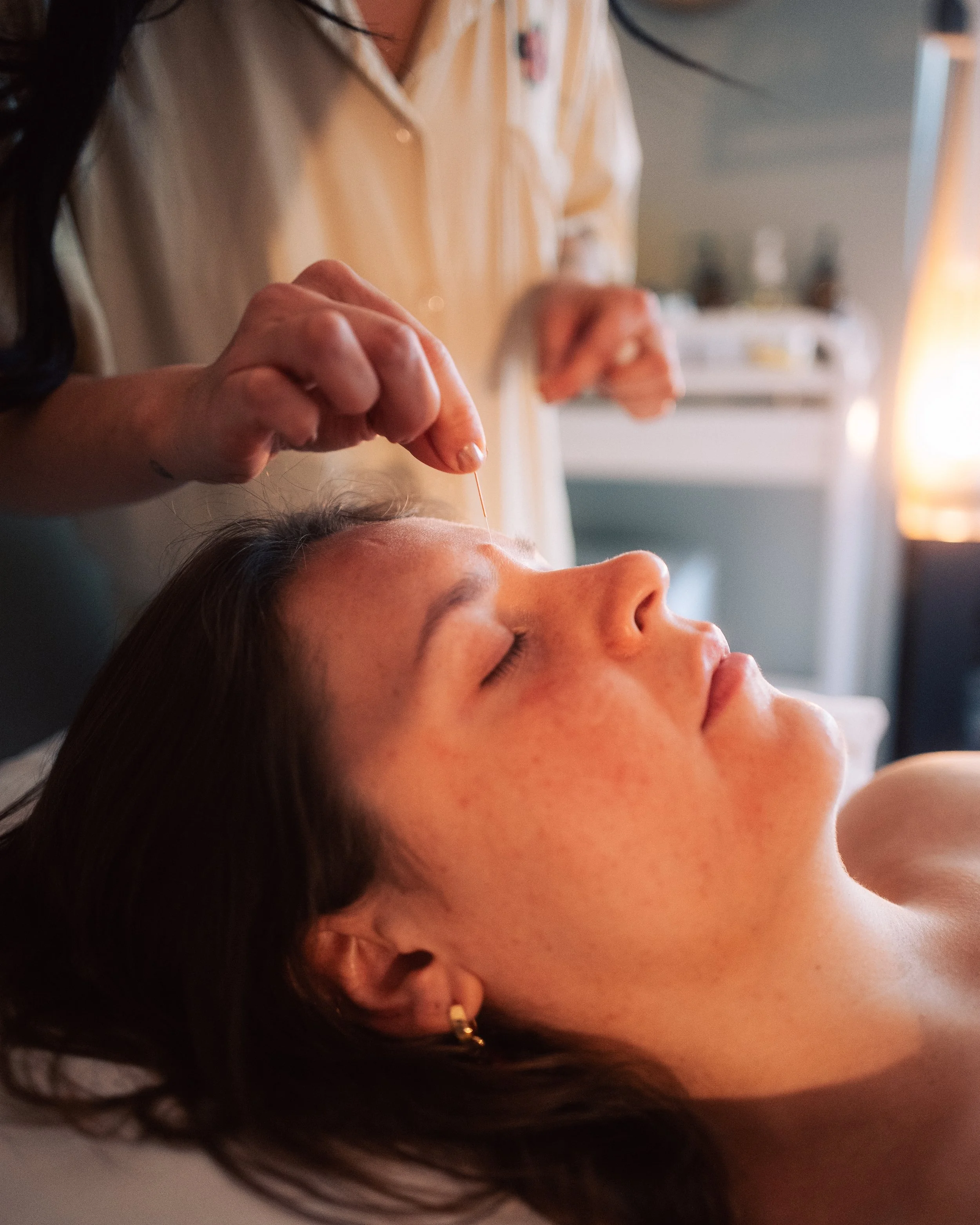 Acusculpting Calgary