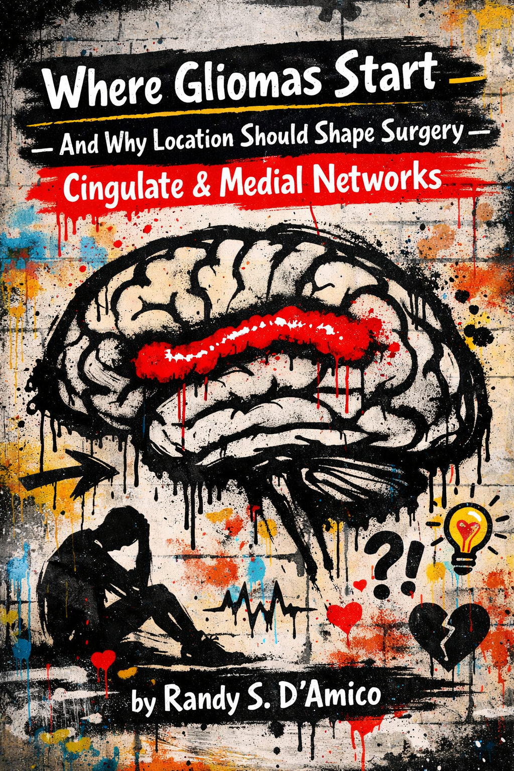 Where Gliomas Start — And Why Location Should Shape Surgery - Cingulate &amp; Medial Networks