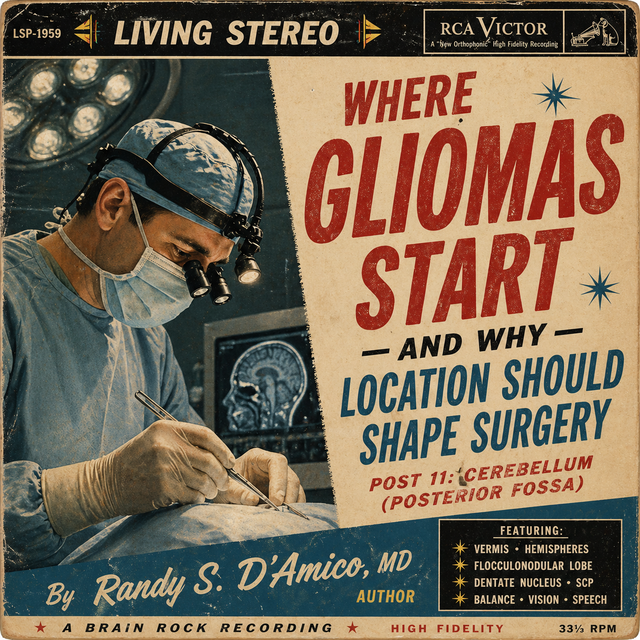 Where Gliomas Start — And Why Location Should Shape Surgery