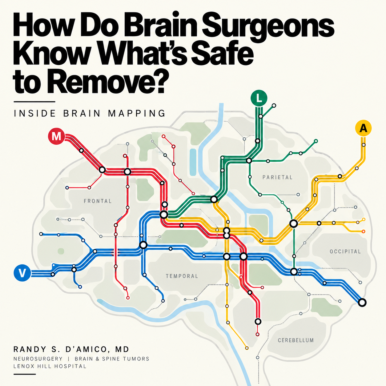 How Do Brain Surgeons Know What’s Safe to Remove?