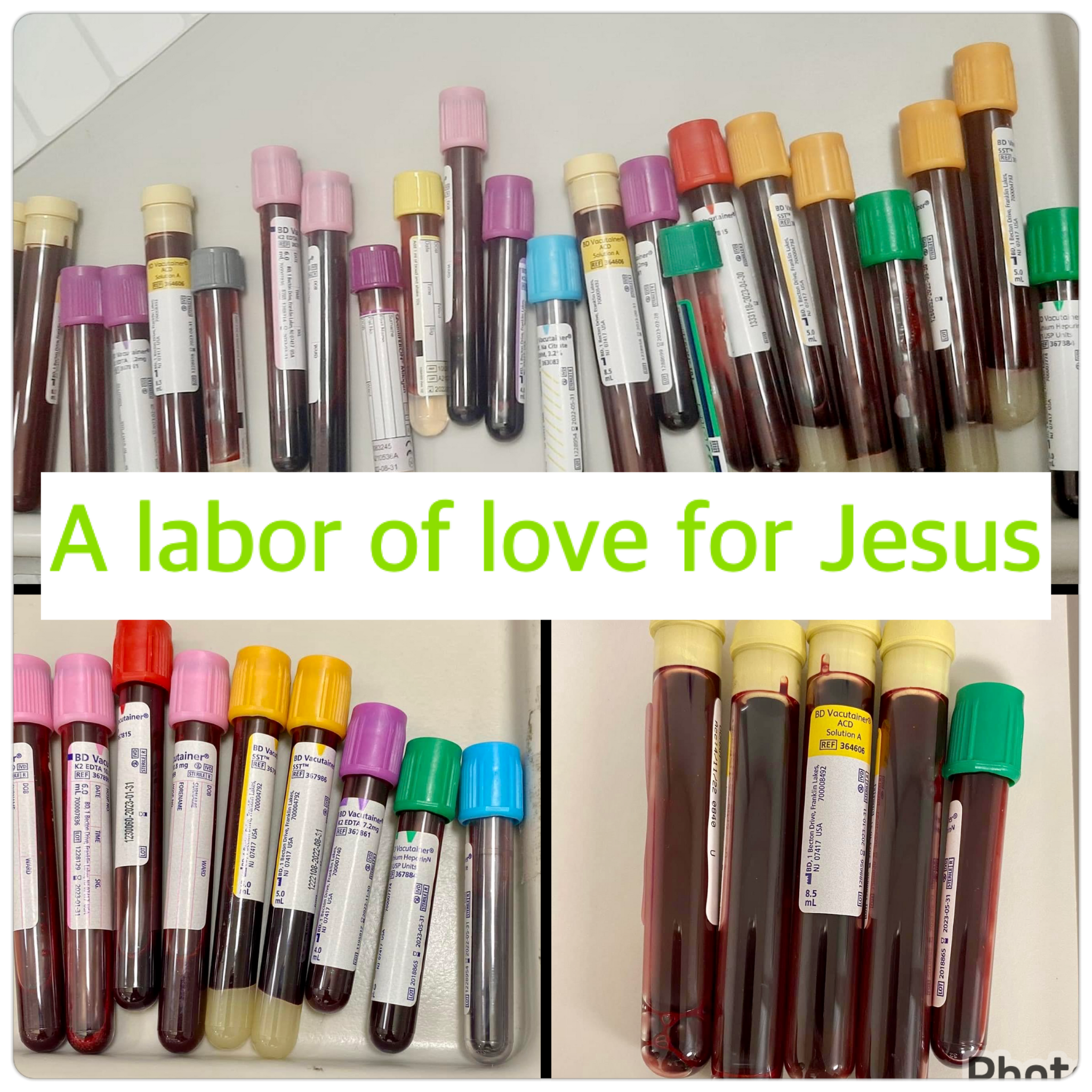 The many vials of blood drawn for the transplant