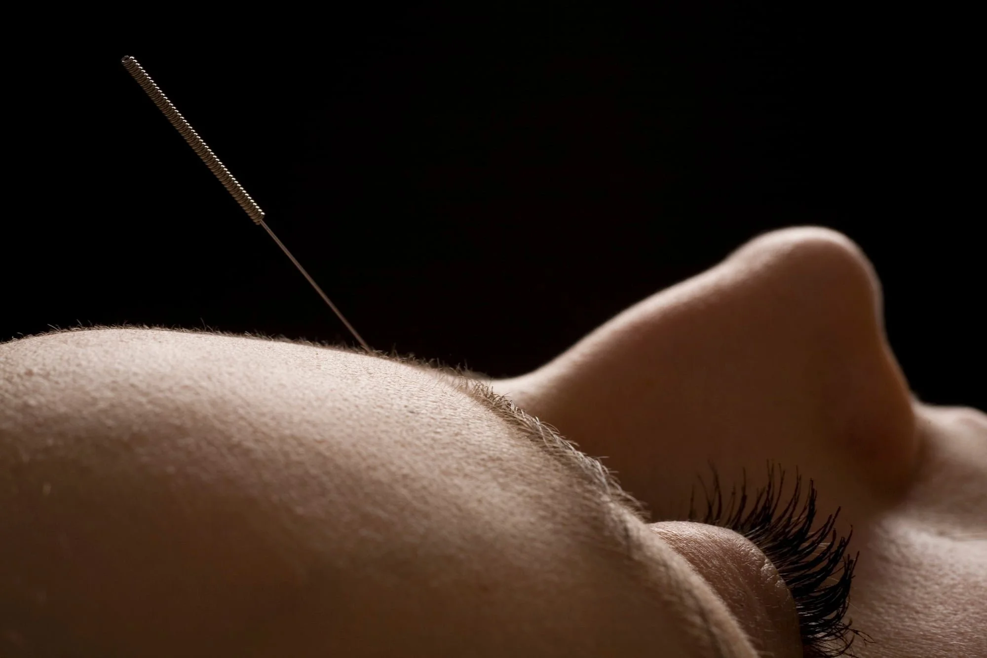 Nahaufnahme eines Gesichts bei einer ästhetischen Behandlung, bei der eine erfahrene Professional ein Instrument an der Wange verwendet, mit Fokus auf die Haut und Wimpern im Dunkel.