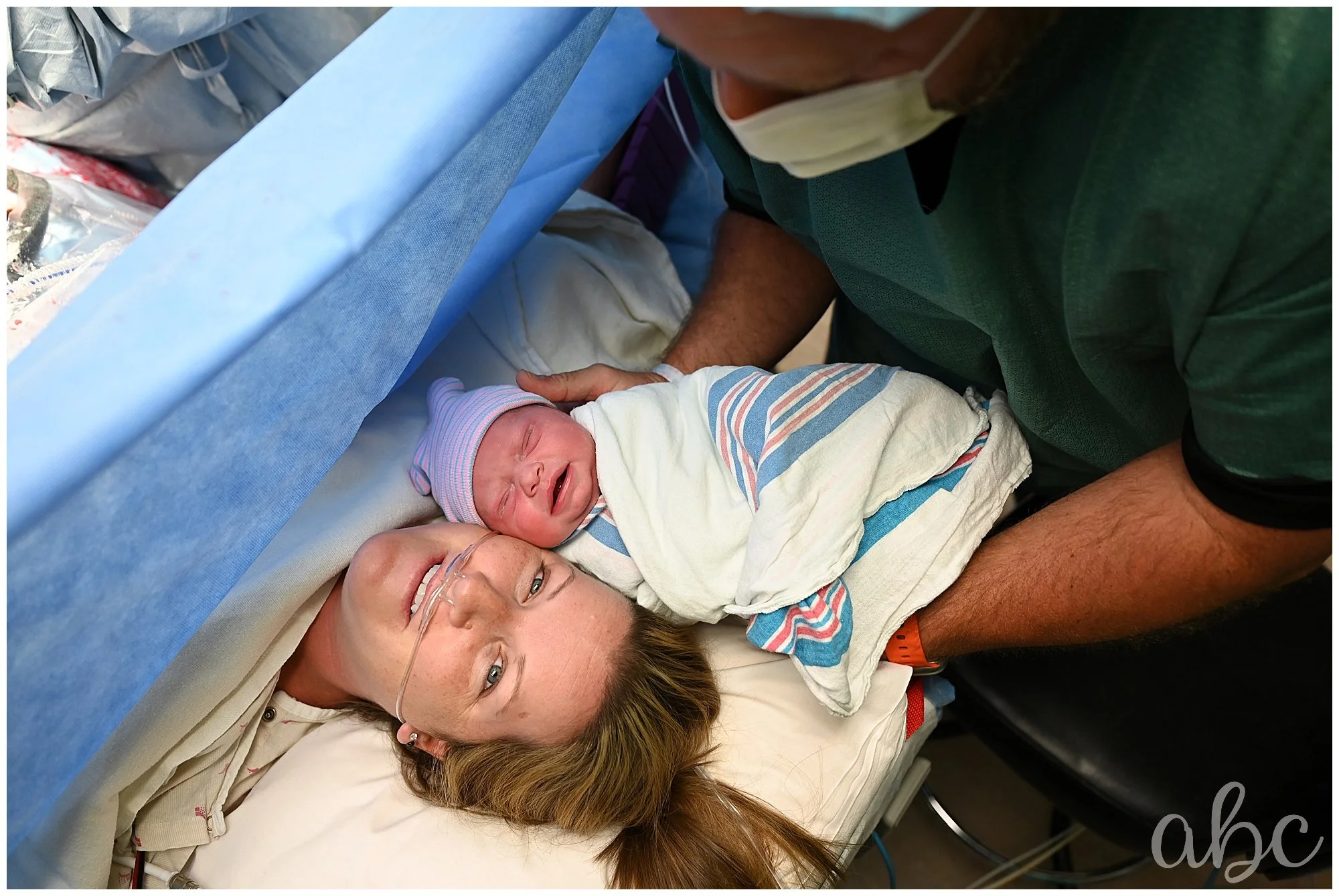 Healing After a Cesarean: Your Scar