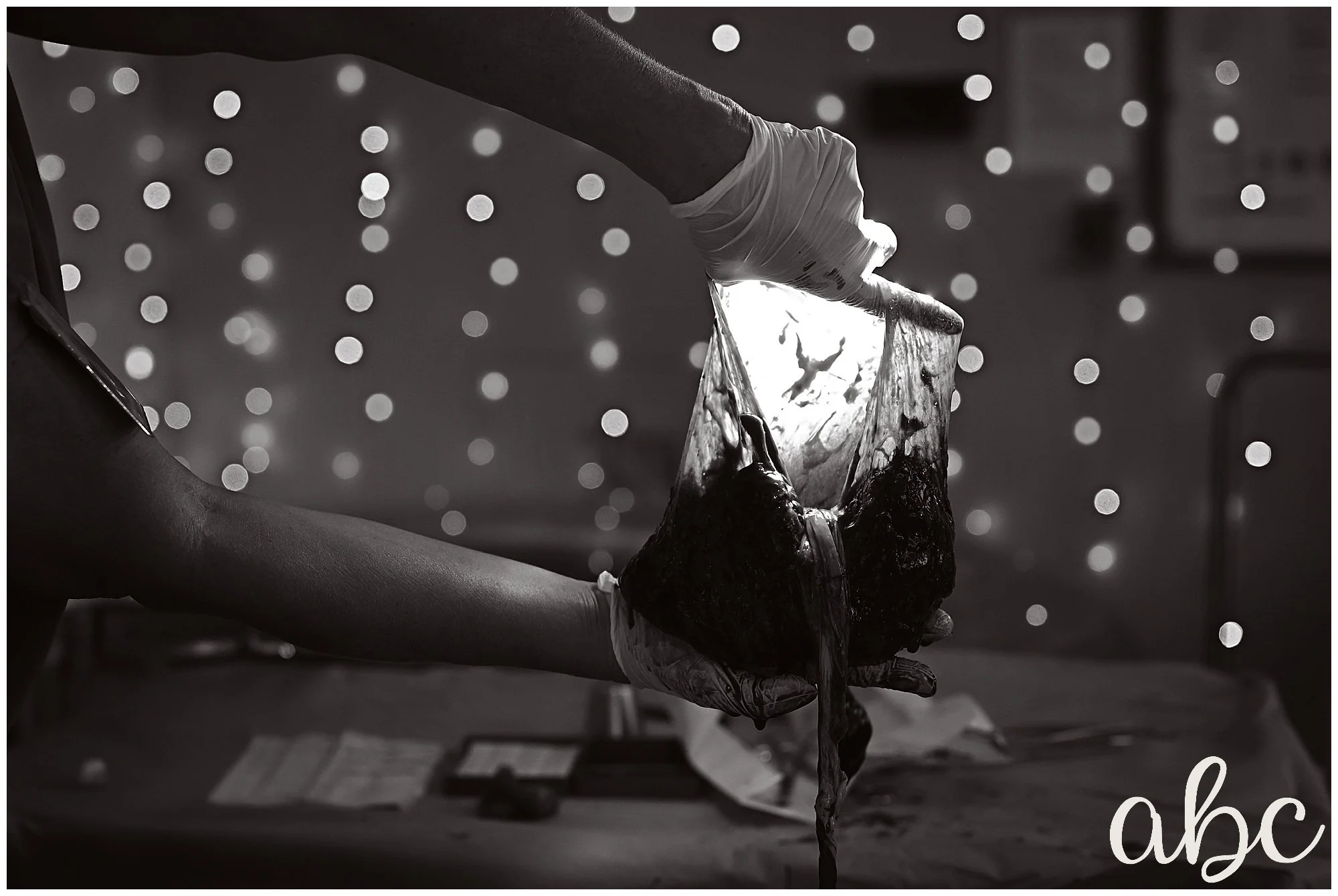 Woodstock Doula Photographer captures bag of waters held up to the light in the hospital