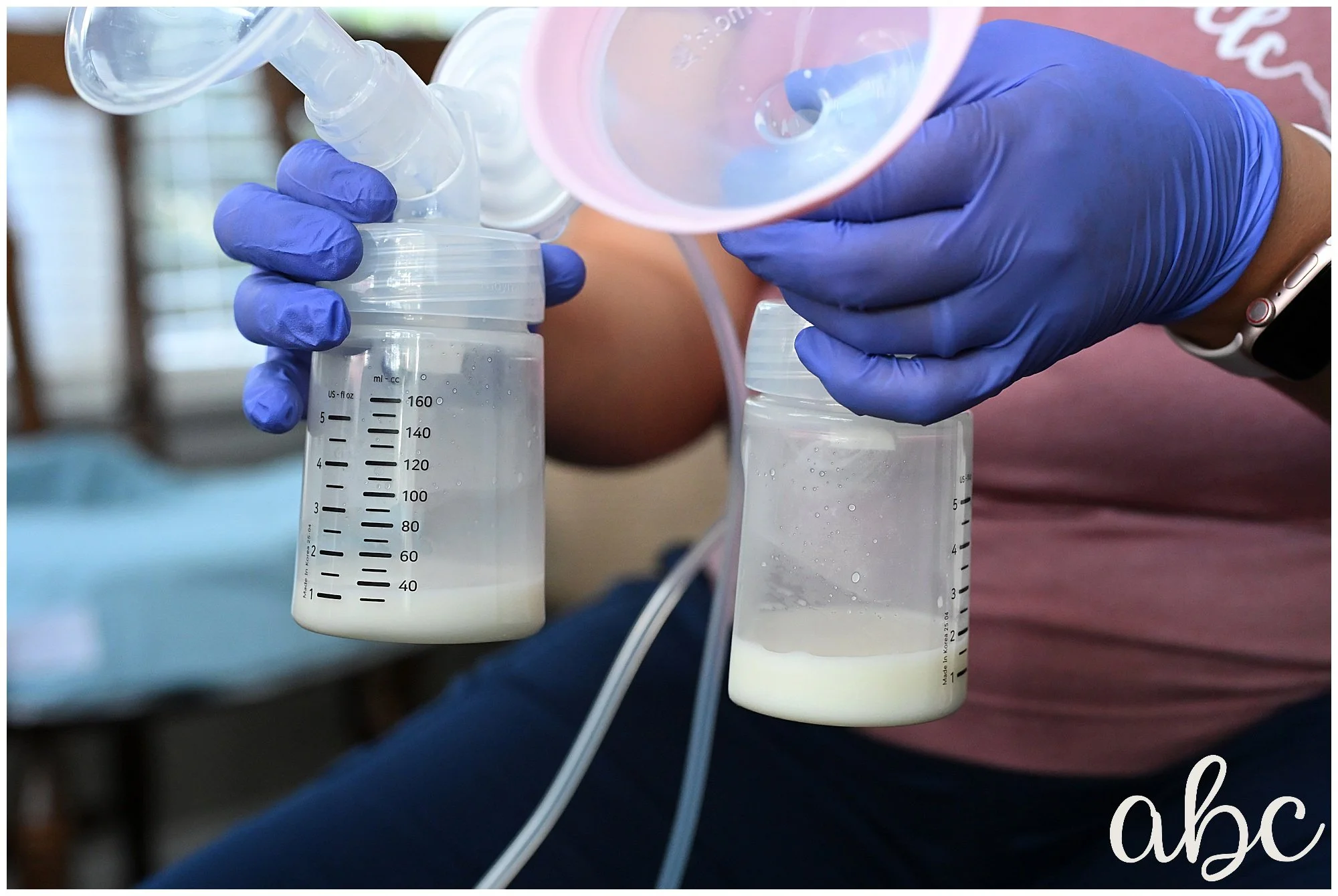 Photograph of pumped breastmilk