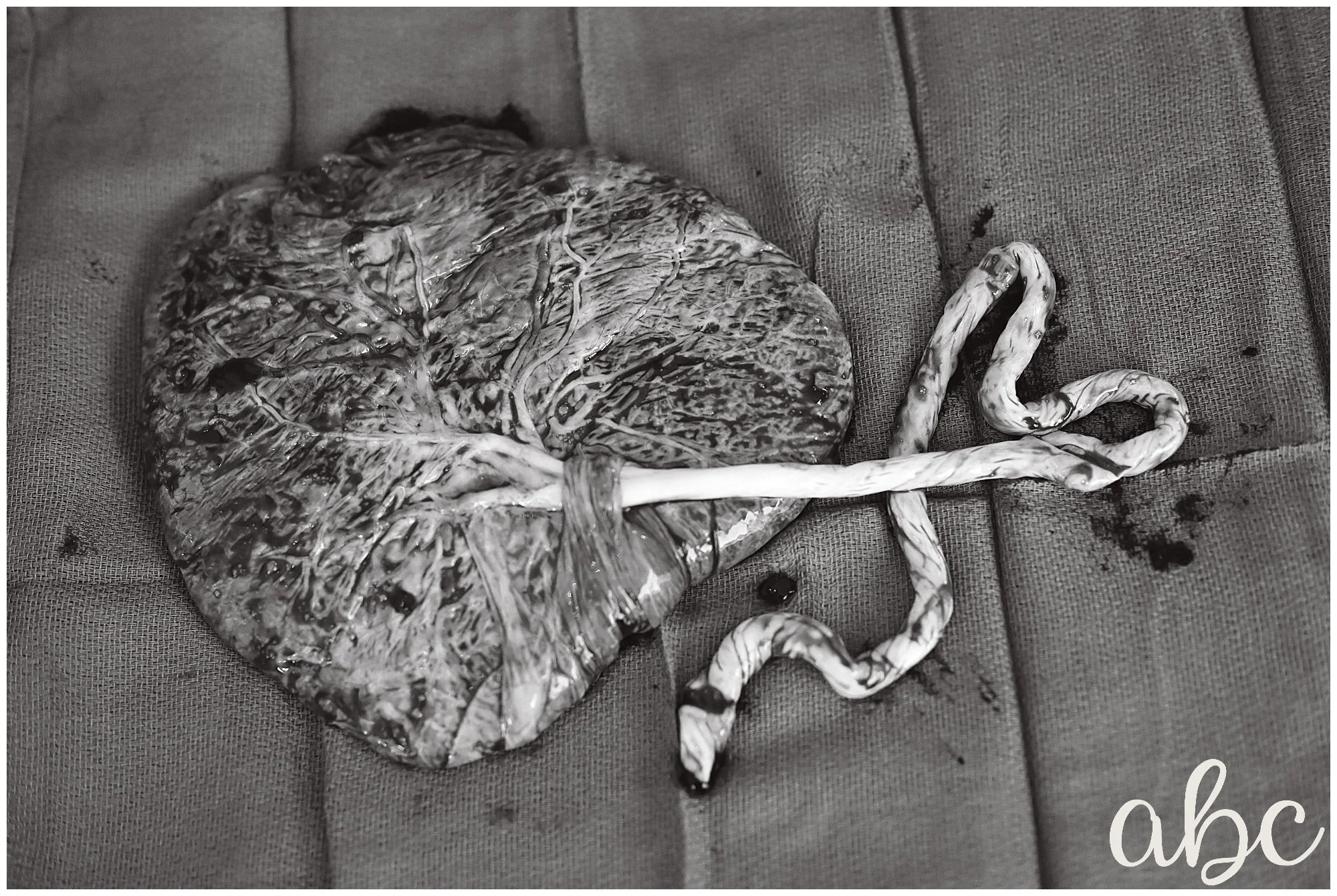 Doula in Woodstock captures image of the placenta's "tree of life"