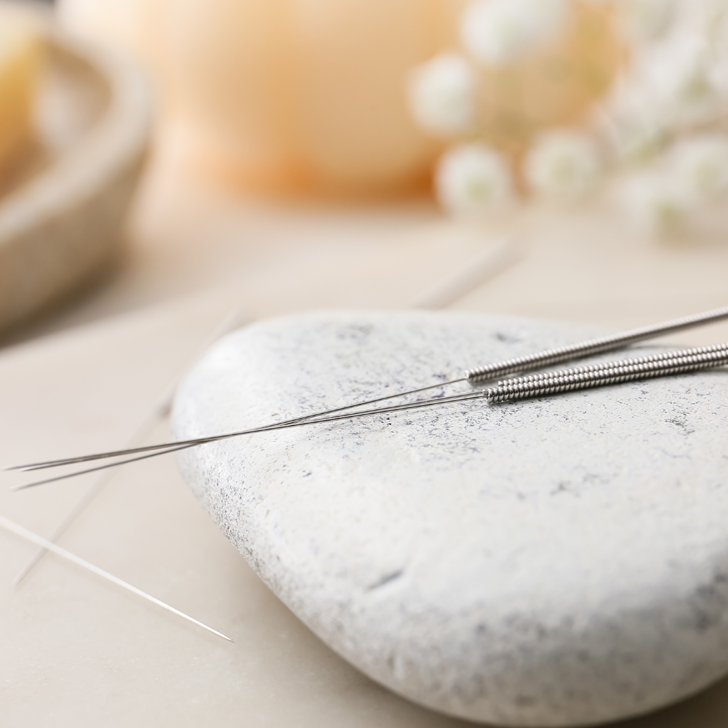 Acupuncture in Mount Pleasant South Carolina