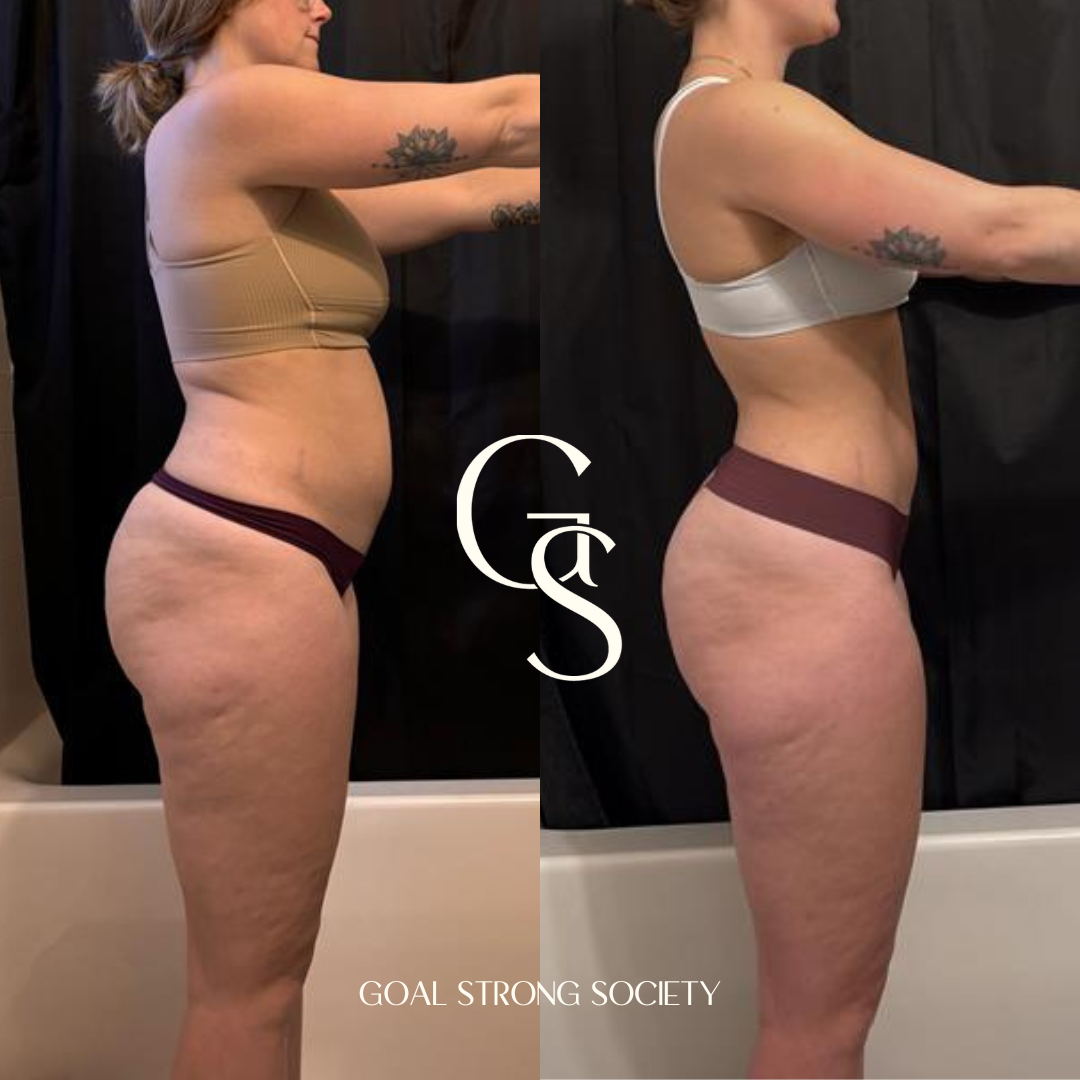 Side-by-side comparison of a woman's body before and after weight loss or body transformation, showing a reduction in body fat and improved muscle tone.