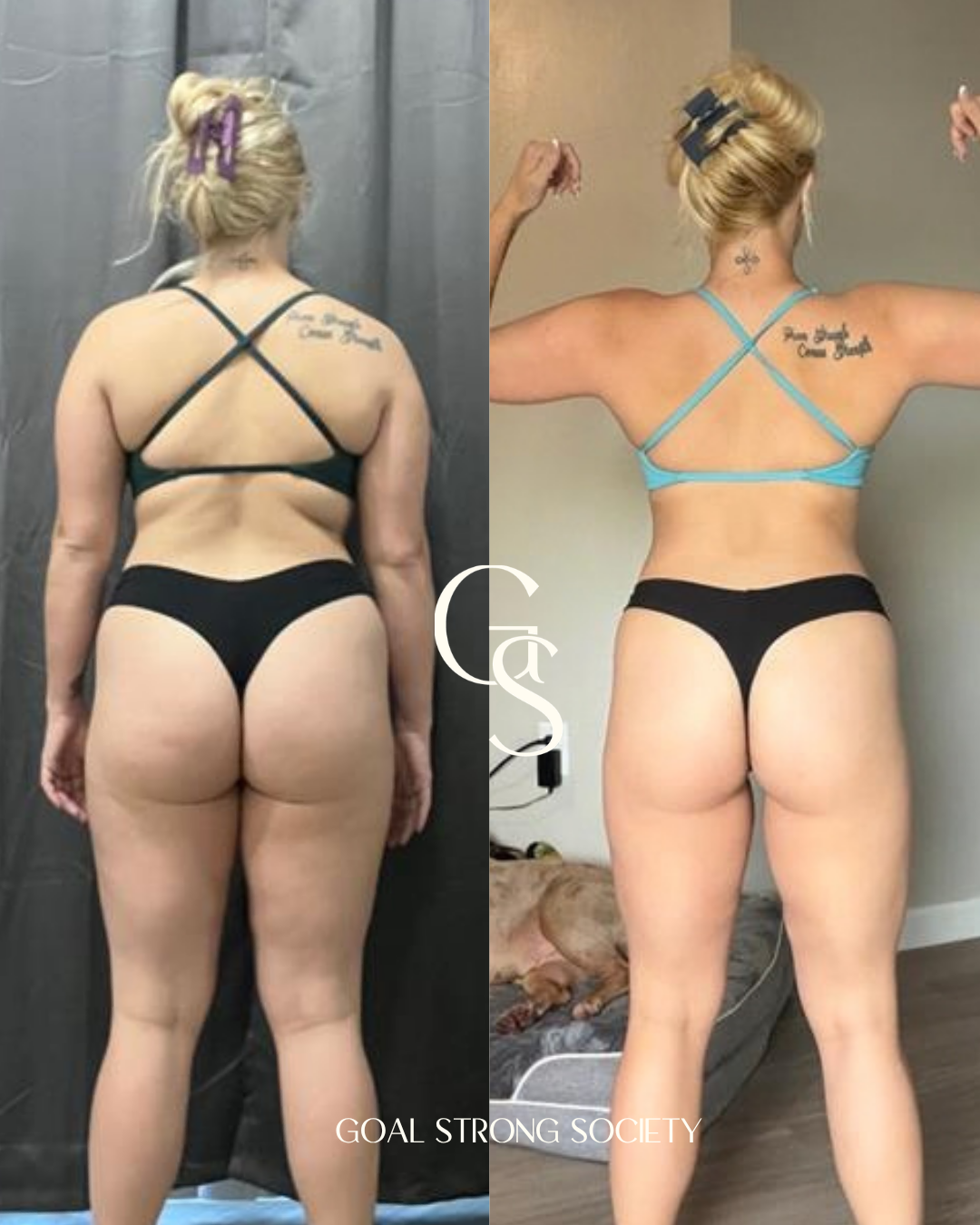 Side-by-side comparison photo showing a woman before and after weight loss or body transformation, wearing black and gray underwear.
