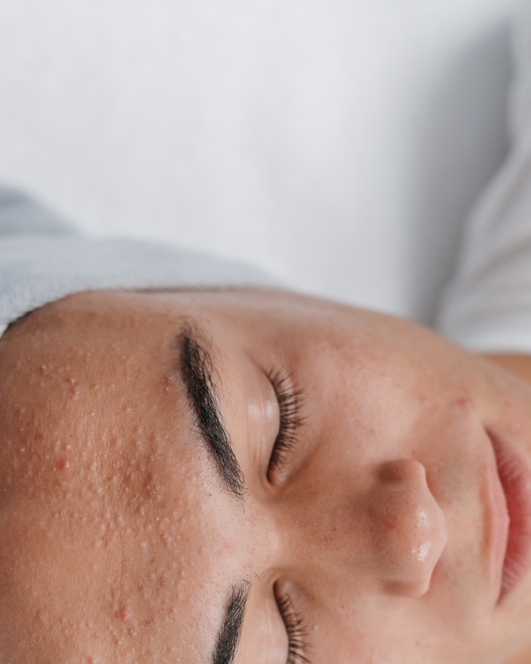 Facial treatment for men at Unforgotten Skin Bristol