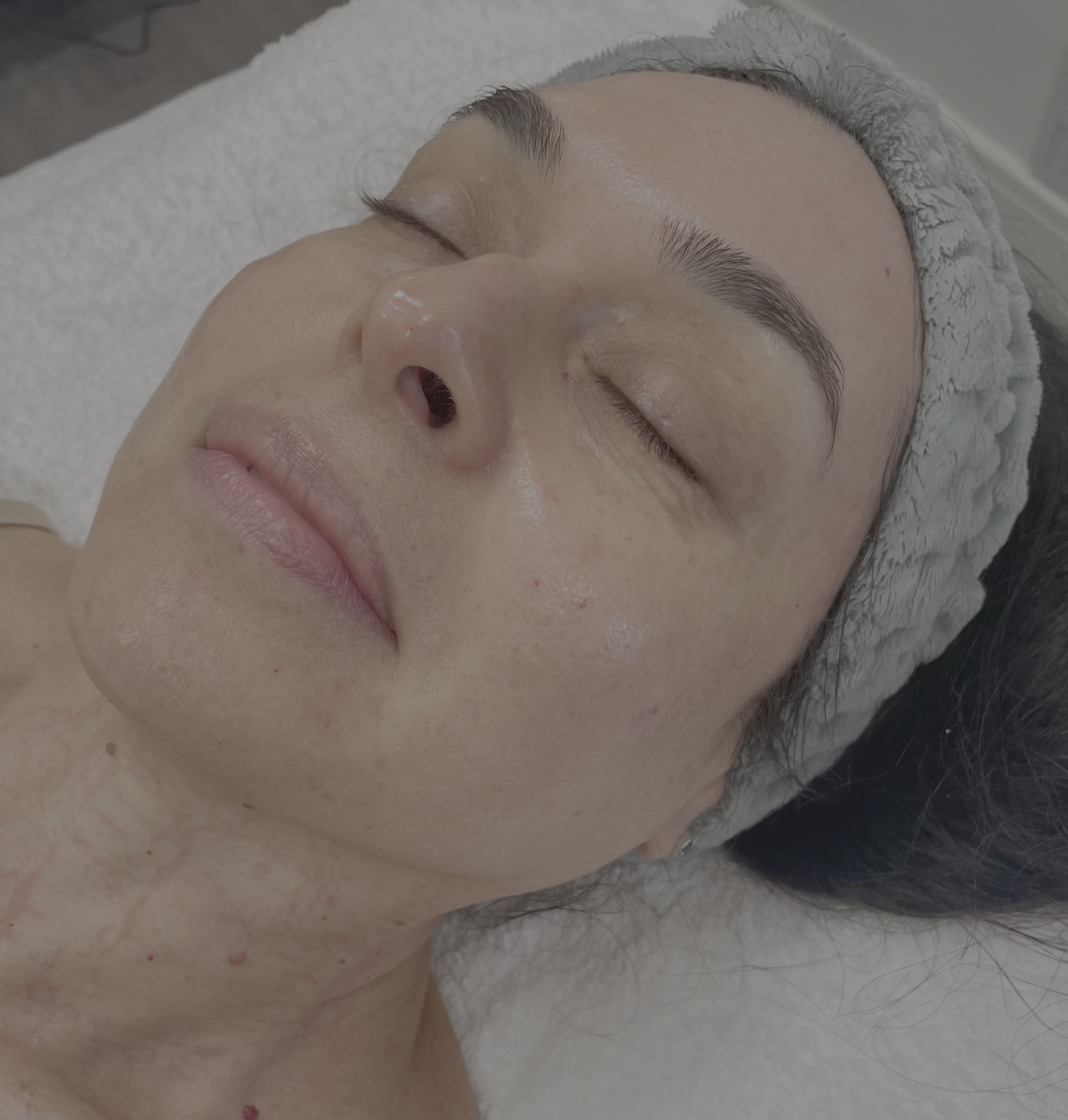 Skin health consultation and facial treatment at Unforgotten Skin Bristol