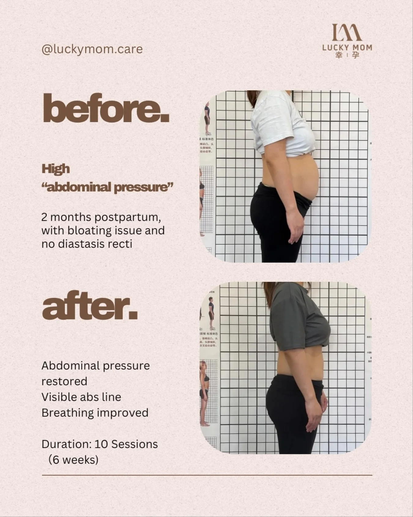 From Bloating to Abs in Just 6 Weeks 🤩

This mama started 2 months postpartum with high abdominal pressure and bloating. After just 10 customized rehab sessions &mdash; including breathing training, core activation, and fascia therapy &mdash; her co