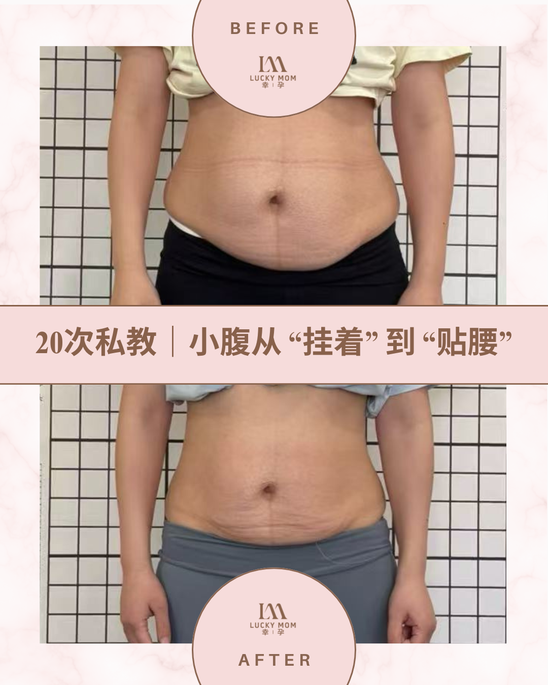 案例：产后核心修复