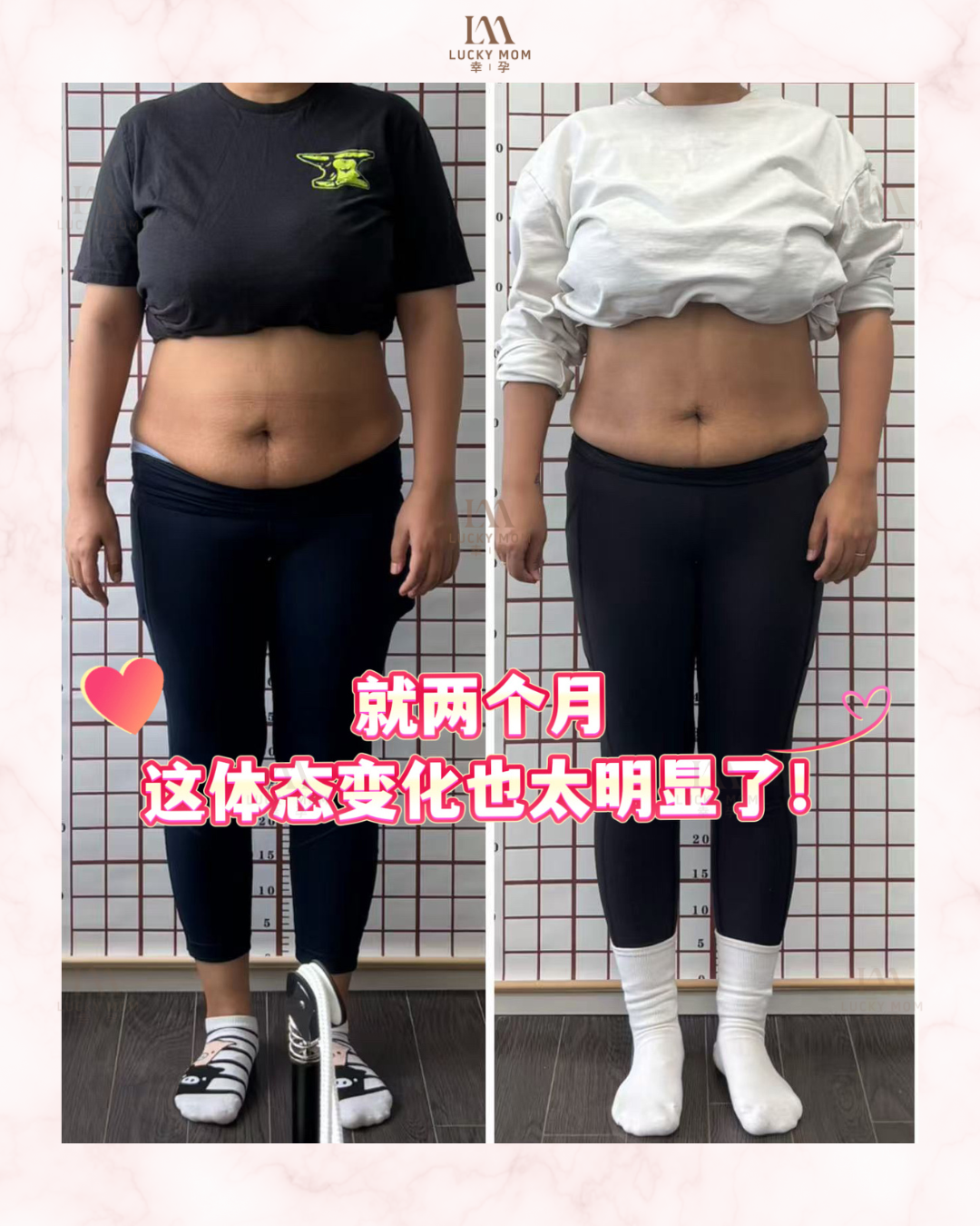 案例：产后体态修复