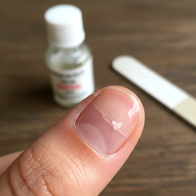 How to Fix Cracked Nail